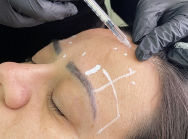 Rejuvenescimento Facial