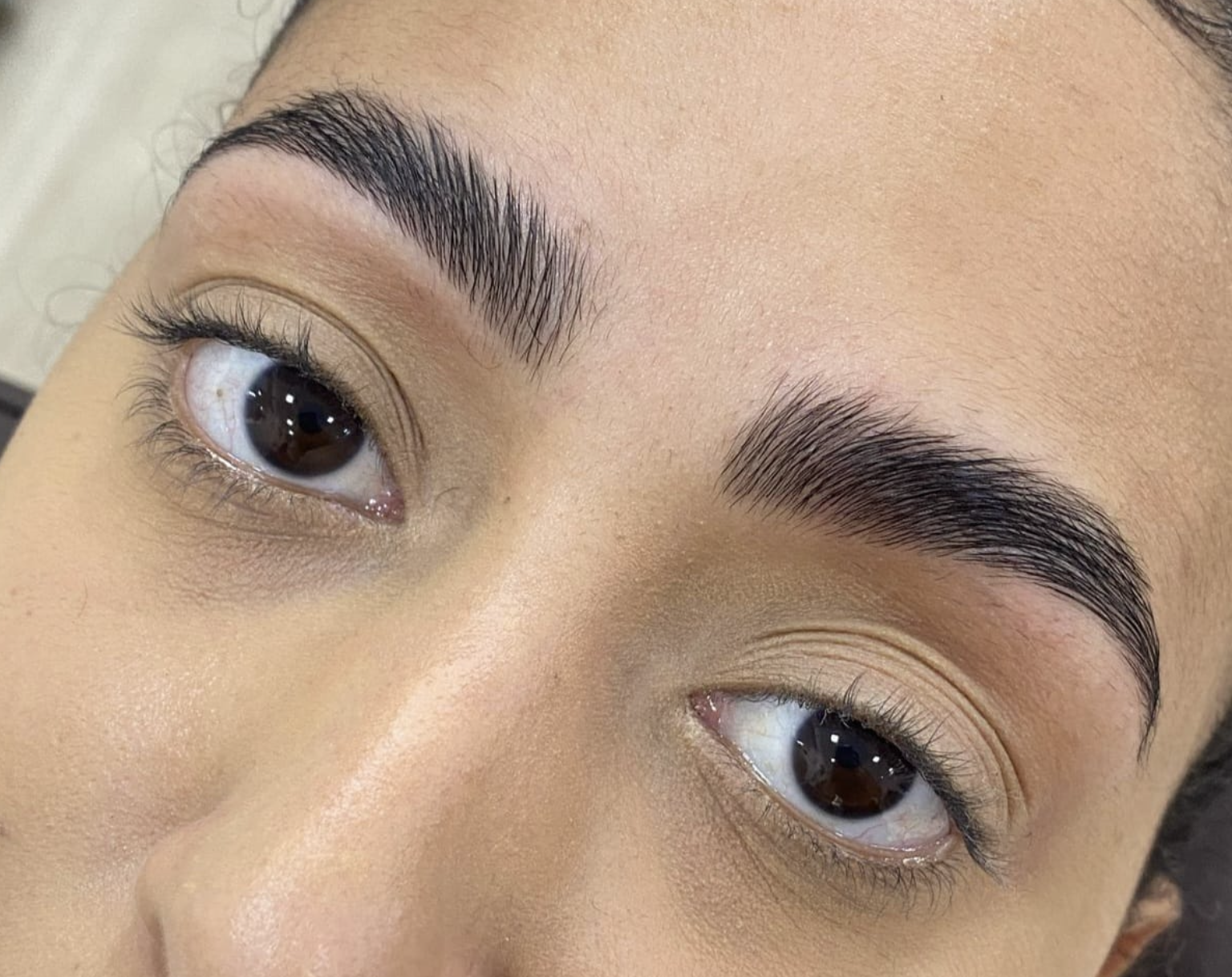 Brow Lumination