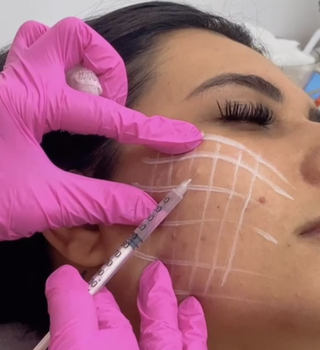 Skinbooster